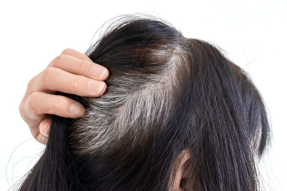 Grey Hair Solutions Nobody Told You Till Now: Natural Remedies That Really Work